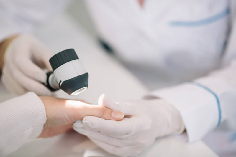Are you tired of Dealing with Acne? Let a Dermatologist Help You